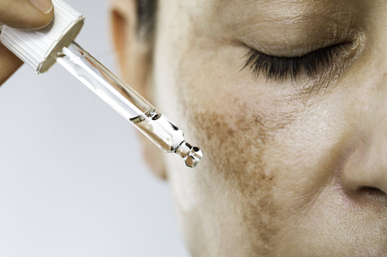 dalle discromie ai tessuti dell area intima cosa possono fare gli esosomi due medici spiegano i protocolli le precauzioni e i limiti delle evidenze scientifiche