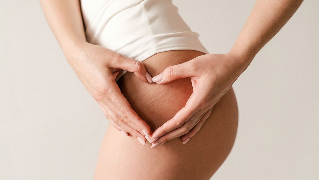 Smagliature seno, gravidanza o adolescenza: rimedi