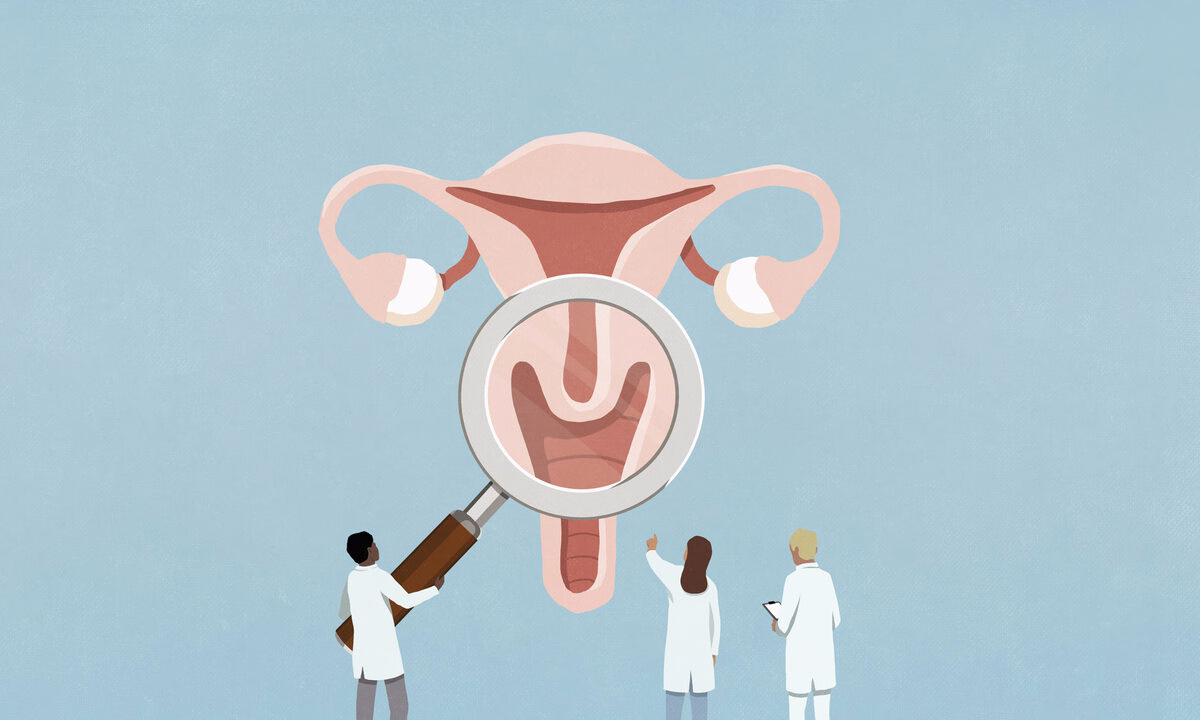 Mestruazioni solo quattro volte l’anno. Questo è davvero il futuro della fertilità femminile?