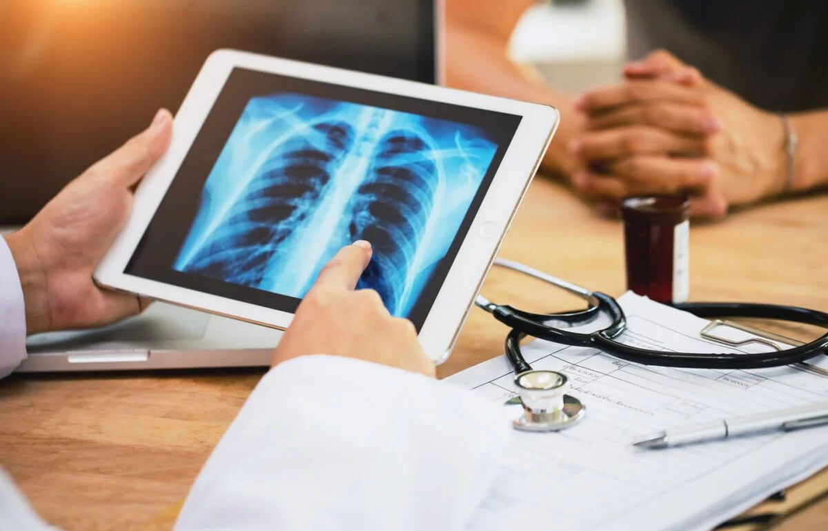 una ricerca pubblicata su science analizza oltre 33 milioni di persone e identifica una variante genetica associata al tumore del polmone nei non fumatori ecco cosa cambia per la prevenzione