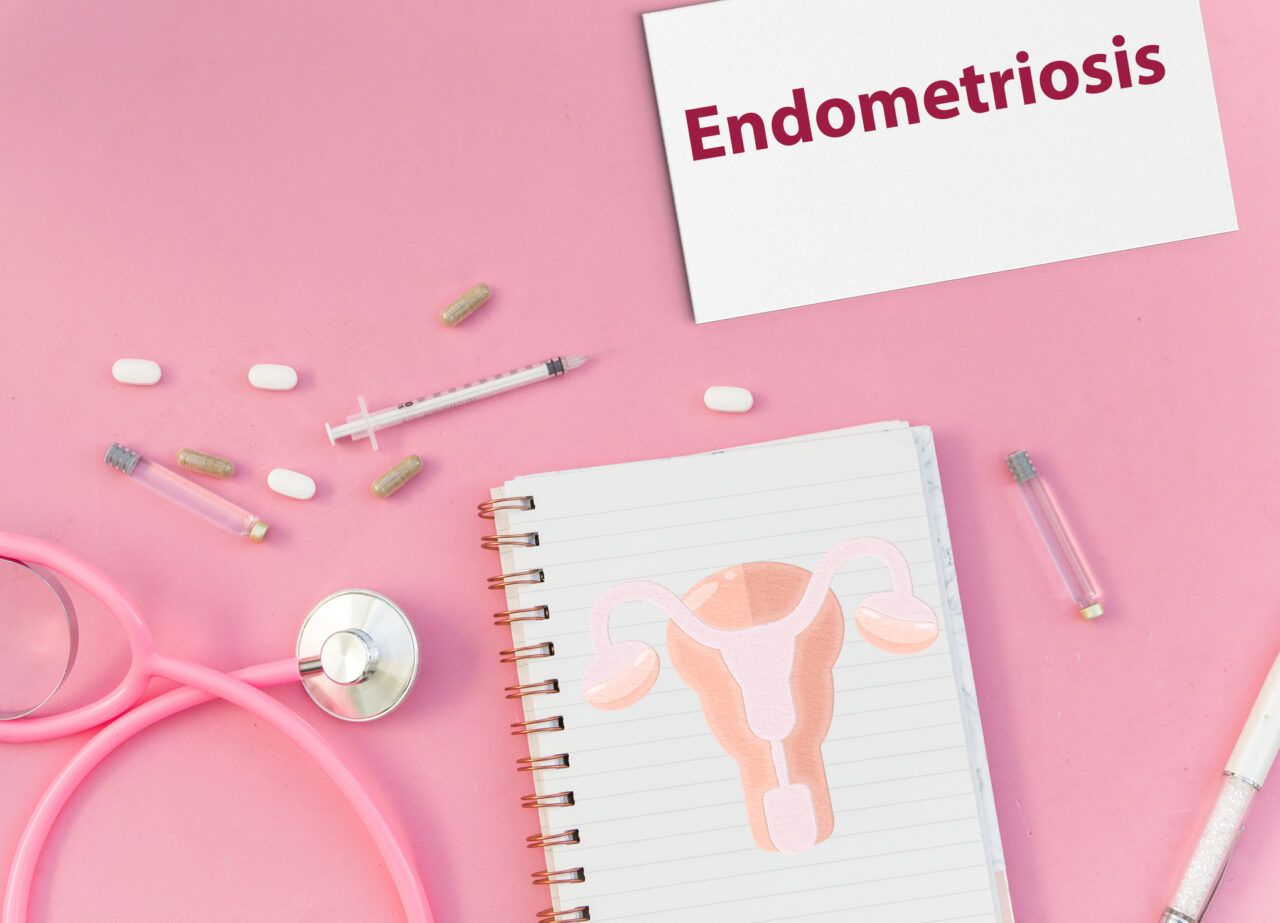 dolore mestruale invalidante disturbi intestinali e altri segnali spesso trascurati il decalogo degli esperti per riconoscere l endometriosi